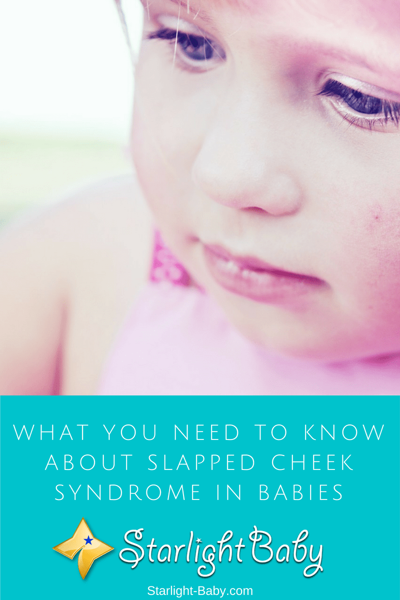 What You Need To Know About Slapped Cheek Syndrome In Babies Kinacle