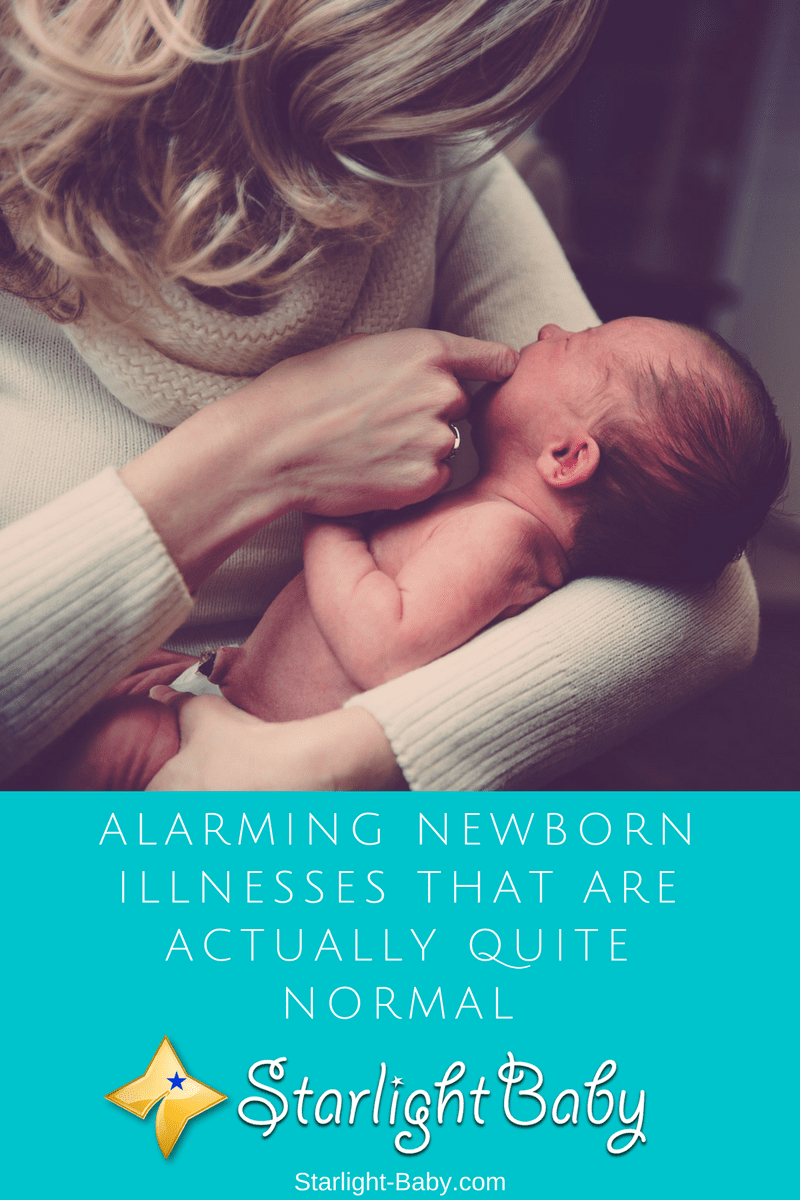 alarming-newborn-illnesses-that-are-actually-quite-normal-kinacle