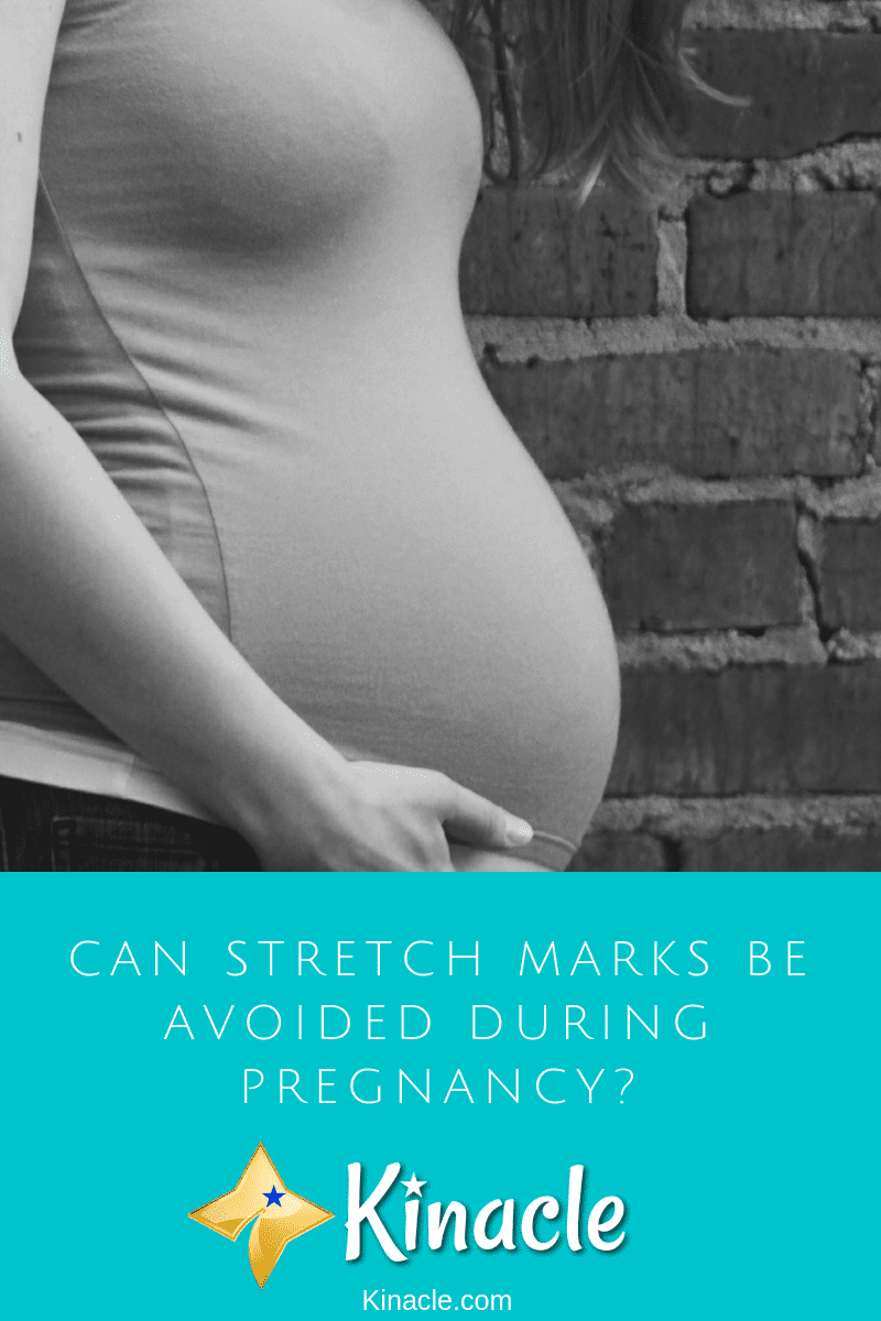 Can Stretch Marks Be Avoided During Pregnancy?