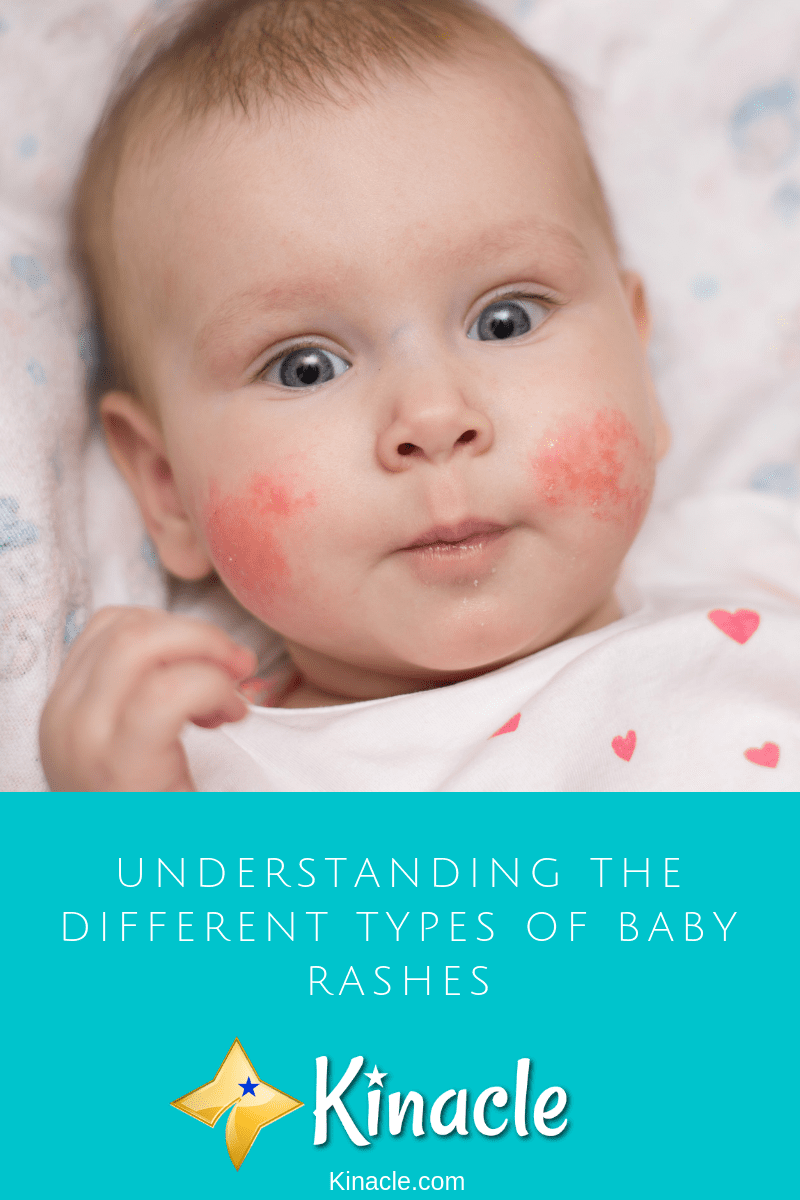 Different Types Of Bumps On Babies